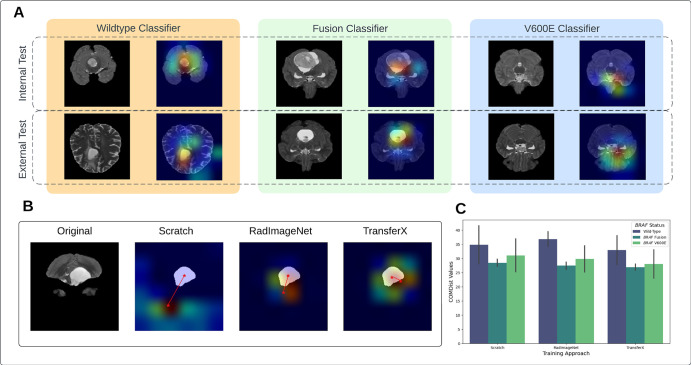 (A) Gradient-weighted class activation map image overlay for each mutational class for internal and external test sets. (B) Center of mass distance (COMDist) representation for the three training approaches. (C) COMDist value comparison of the scan-to-prediction pipeline for each molecular subtype class, with corresponding individual subtype classifiers trained with the three different training approaches.