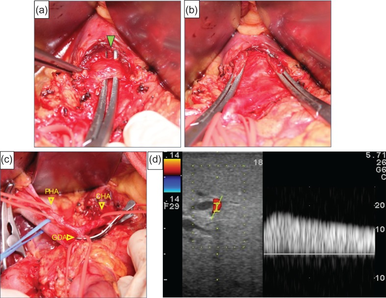 Figure 2: