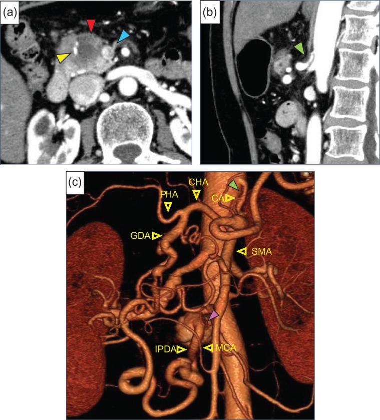 Figure 1: