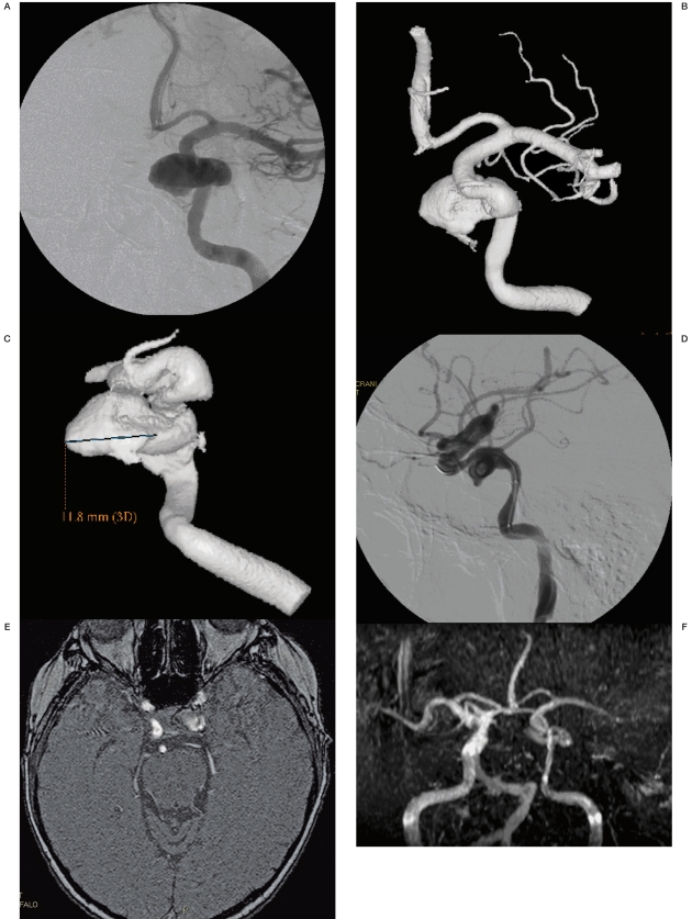 Figure 10 A-F