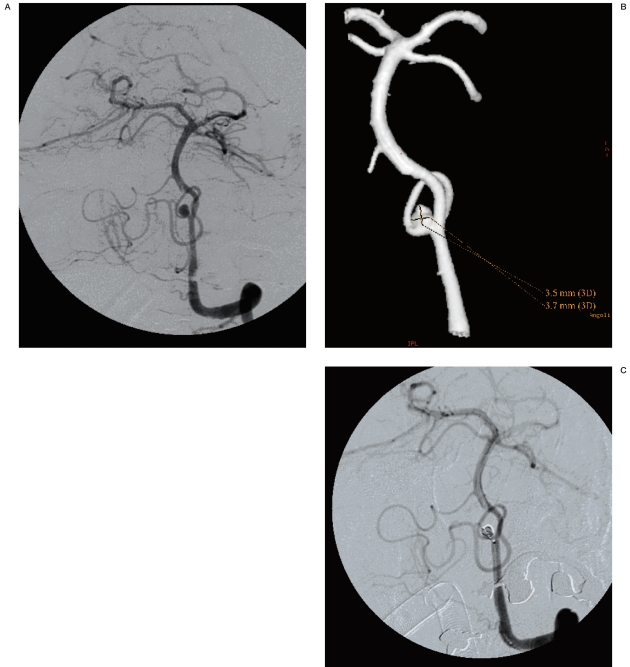 Figure 6 A-C