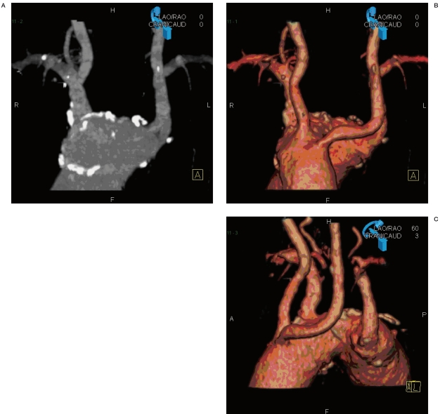 Figure 2 A-C