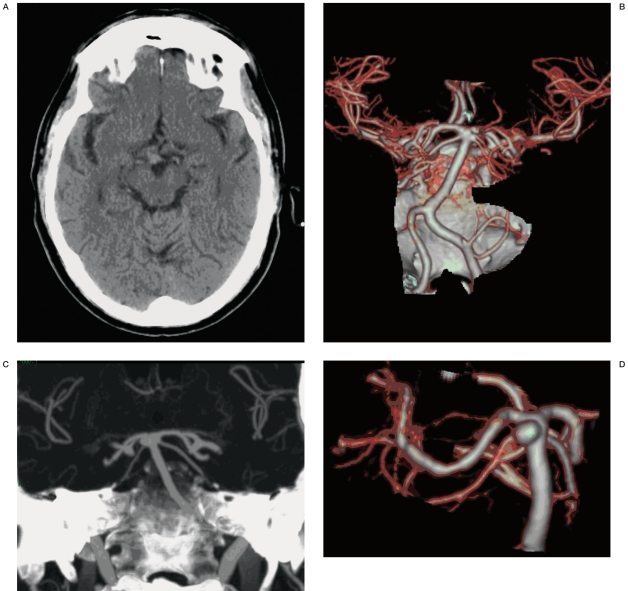 Figure 1 A-D