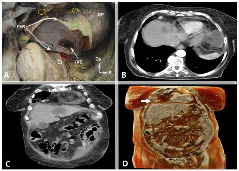 Figure 15