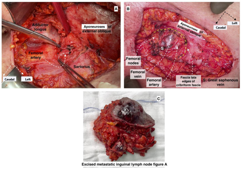 Figure 18