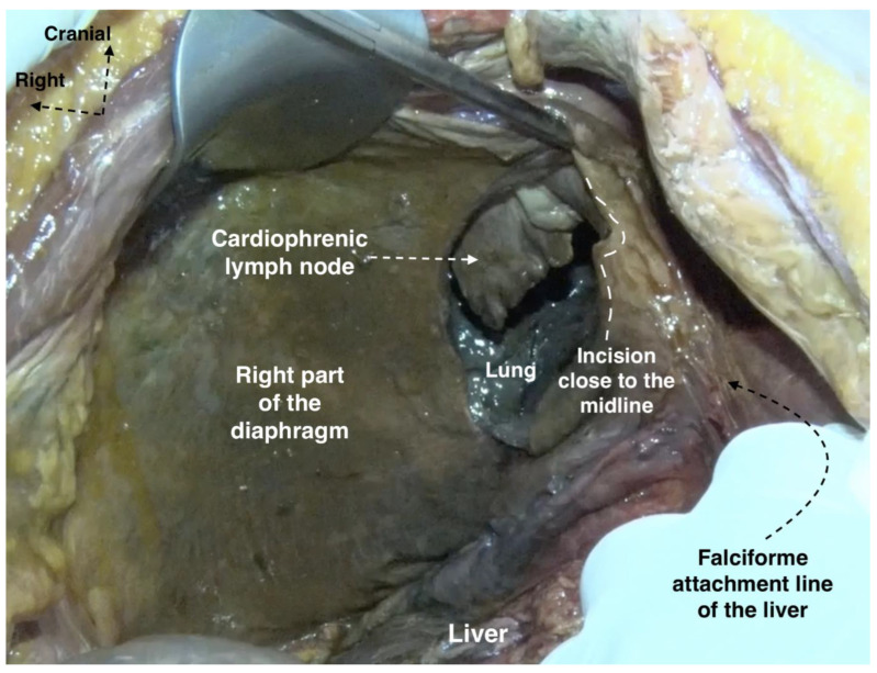 Figure 16