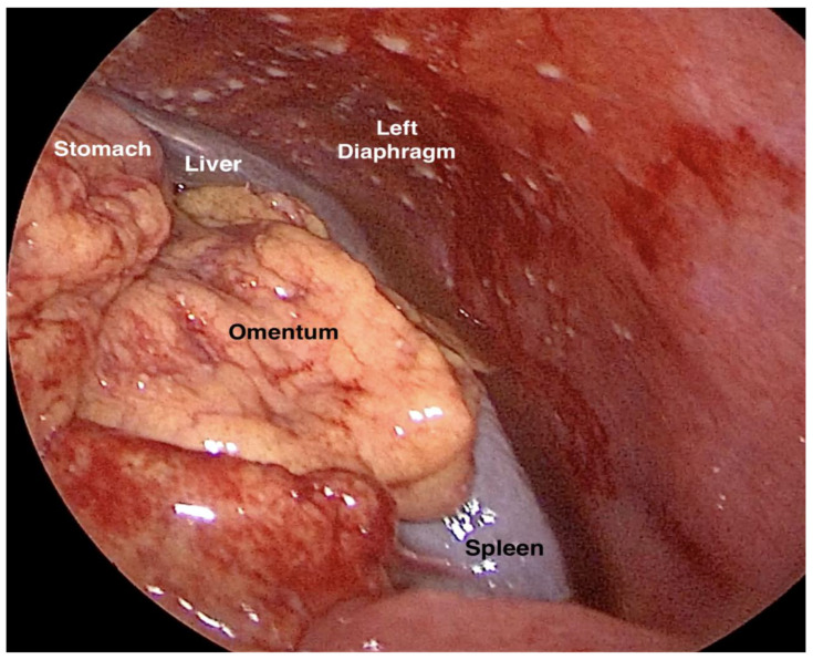 Figure 19