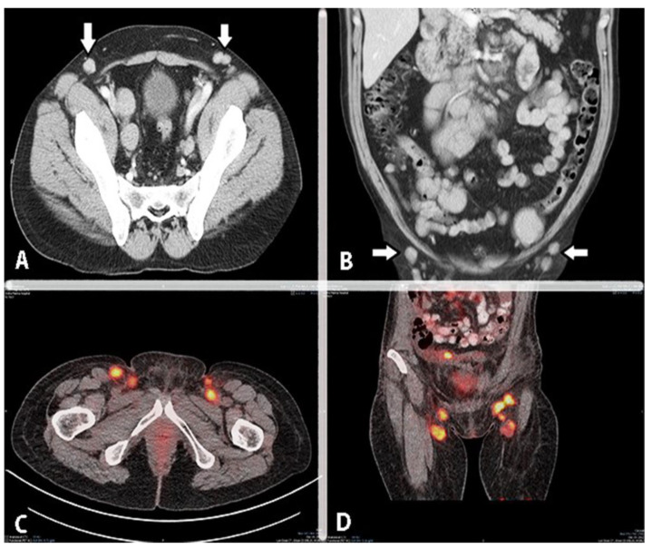 Figure 17