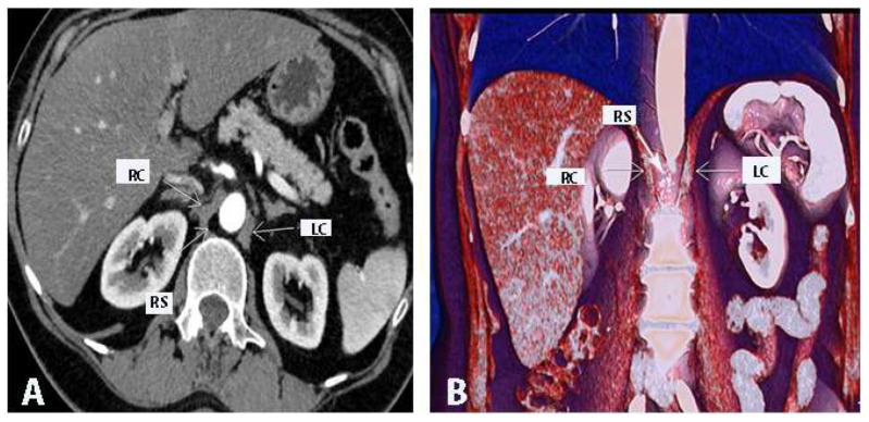 Figure 14