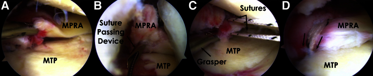 Fig 5