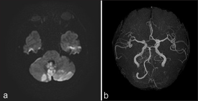 Figure 1: