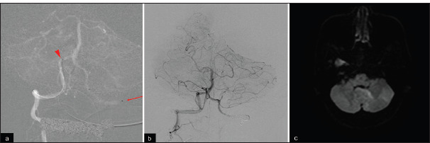 Figure 3: