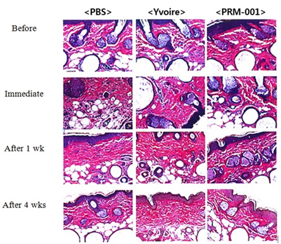 graphic file with name jkms-29-S201-ab001.jpg