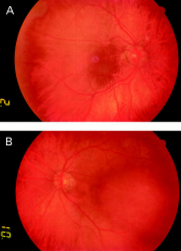 Figure 1  