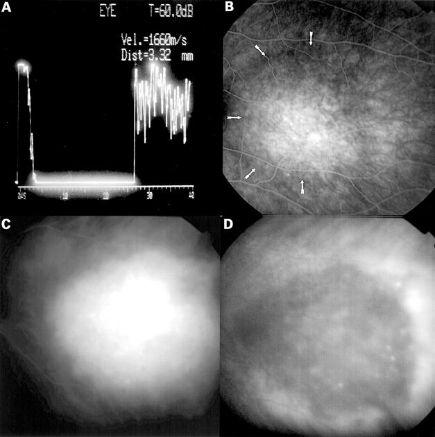 Figure 3  