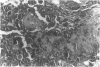 102
