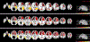 Fig. 11.