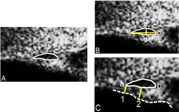 Fig 2