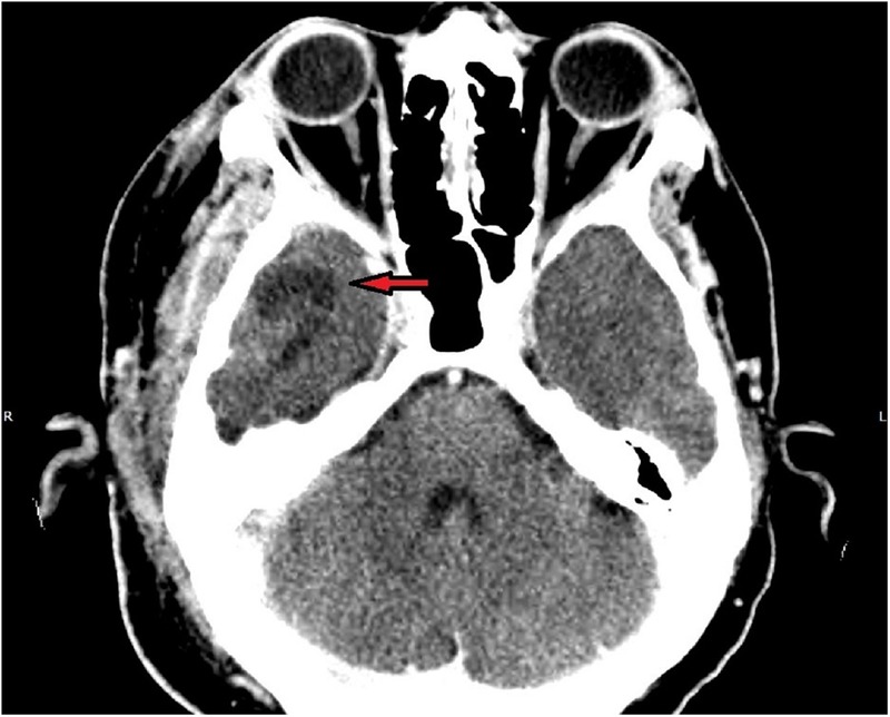 Figure 3