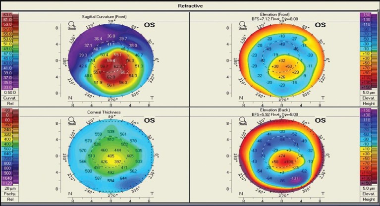 Figure 4