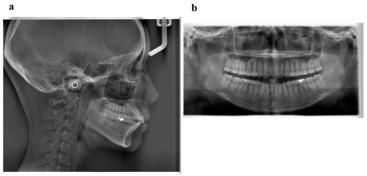 Figure 10