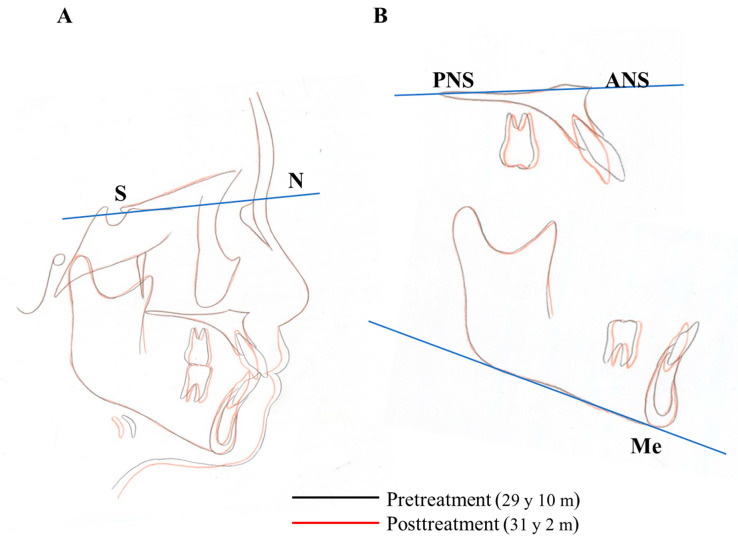 Figure 16