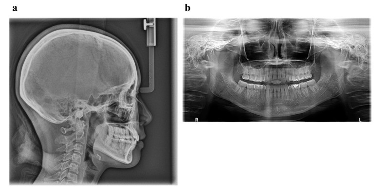 Figure 15