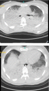 Figure1