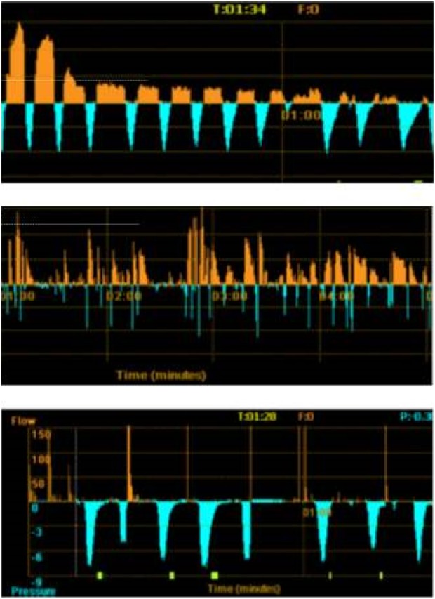 Figure 15.