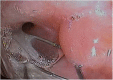 Figure 21.