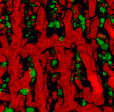 The localization pattern of ankyrin-B (red) and dihydropyridine receptor (green) in cardiomyocytes