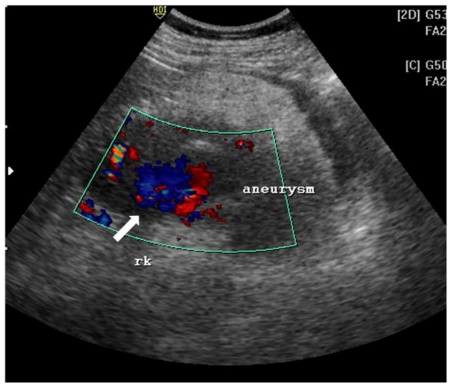 Figure 1b