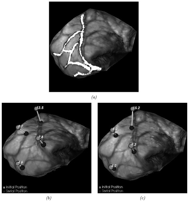 Fig. 12