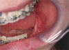 Fig. (10)