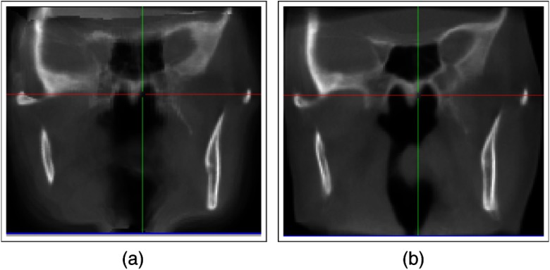 Fig. 13