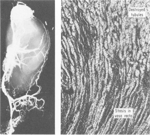 Fig. 3a (left)., 3b (right).