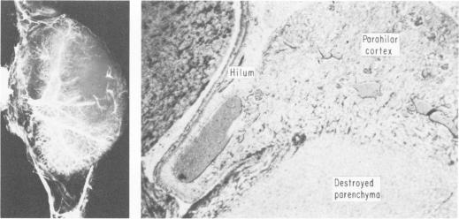 Fig. 4a (left)., 4b (right).