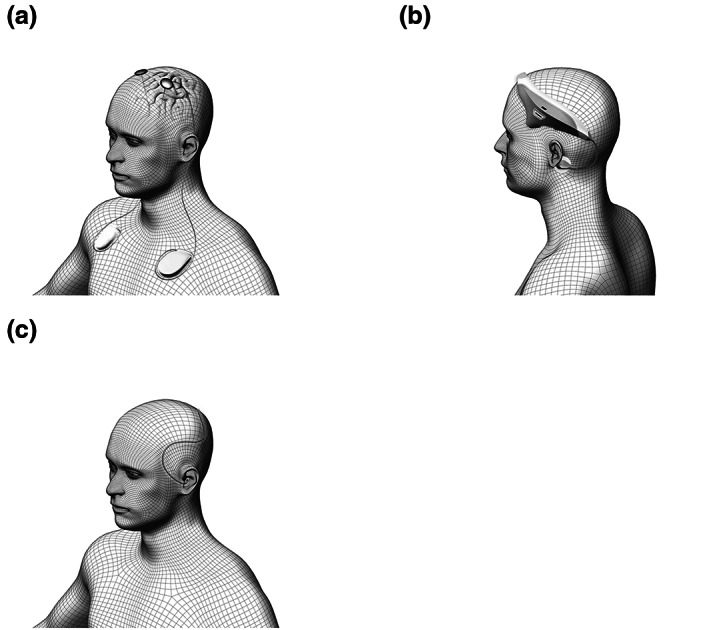 FIGURE 3