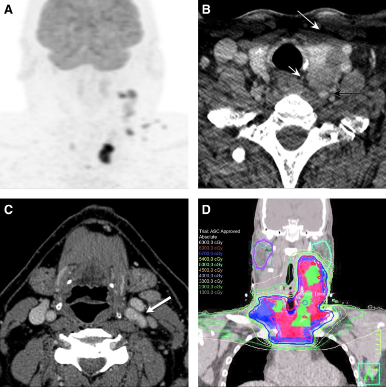 FIG. 2.