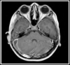 Fig.2