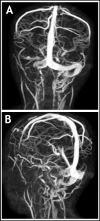 Fig.1a and b