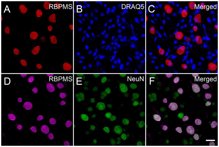 Figure 14