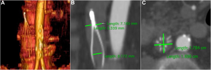 Figure 2