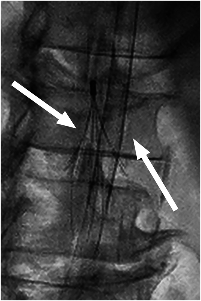 Figure 1