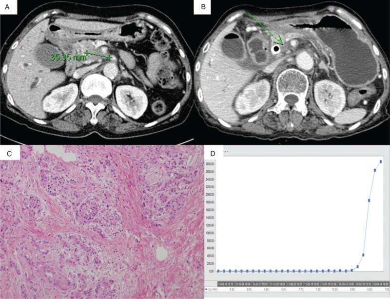 FIGURE 1