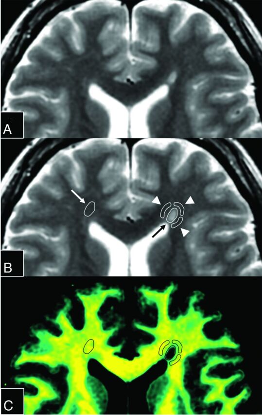 Fig 2.