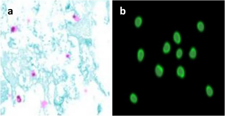 Fig. 1