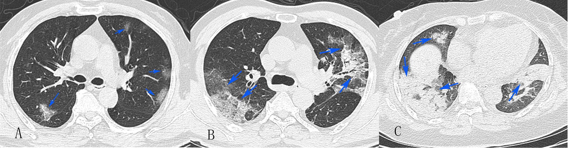 Fig. 1