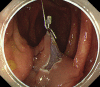 Figure 5