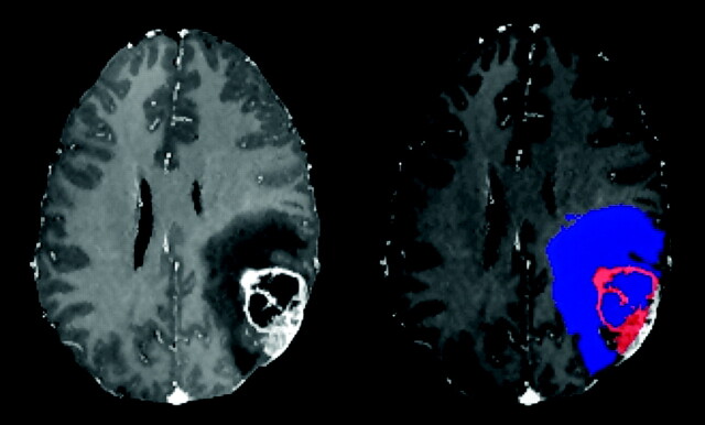 Fig 2.